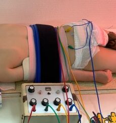 低酸素脳症（HIE）のお子さんが鍼を受けている写真