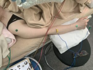 パーキンソン病でお悩みの患者様の施術風景①